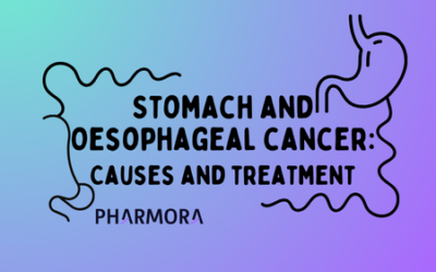 Gastric and Oesophageal cancer: Causes and Treatment